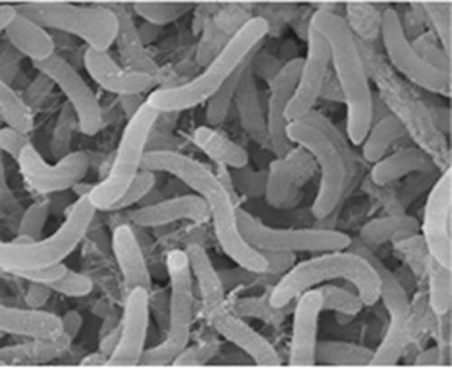 Microscopic photo of <i>Pelagibacter ubique</i>